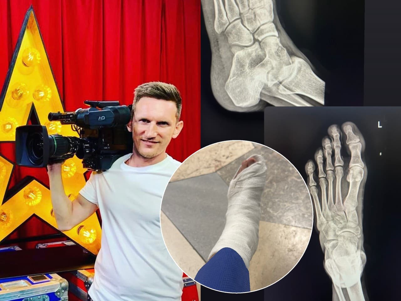 Malý Mišo sa vážne zranil