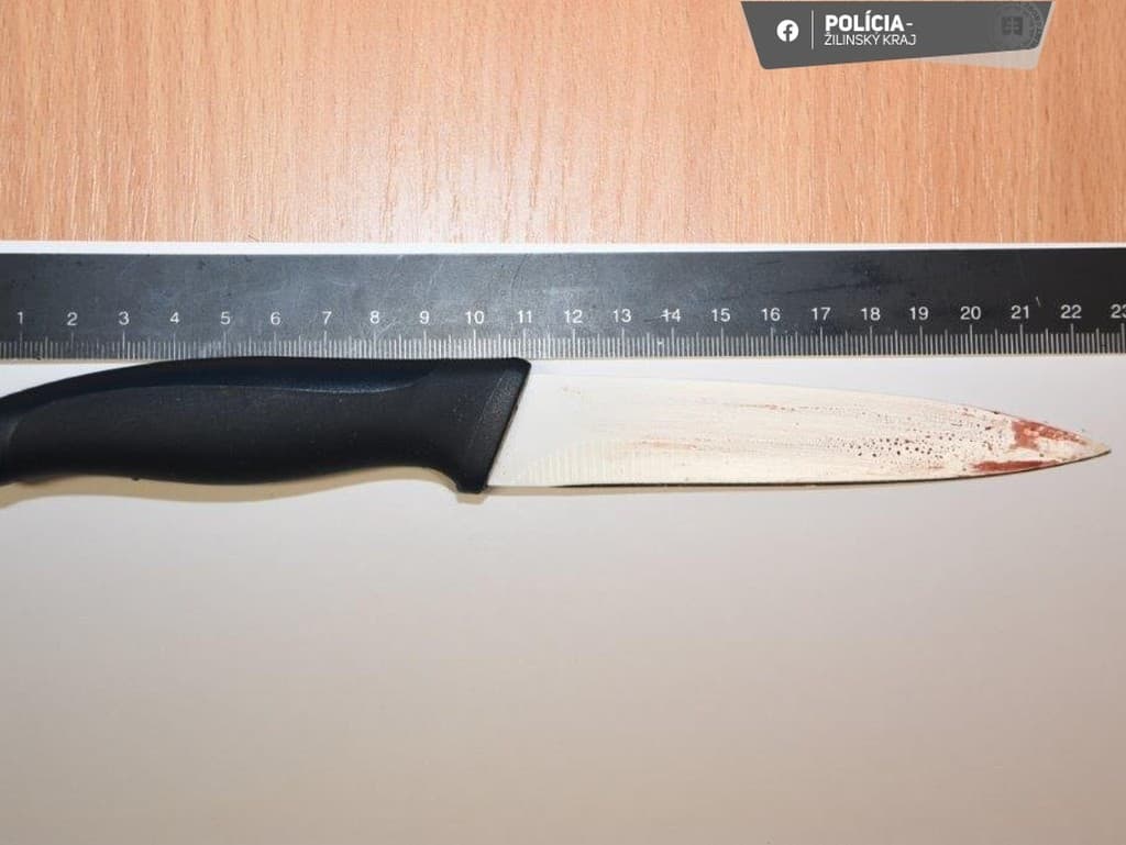Žena pod vplyvom alkoholu nožom napadla 37-ročného muža.