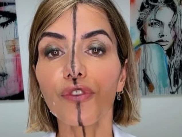 Bita Farrellová s botoxom a bez.