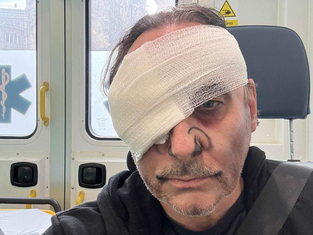 Marián Vojtko sa vážne zranil