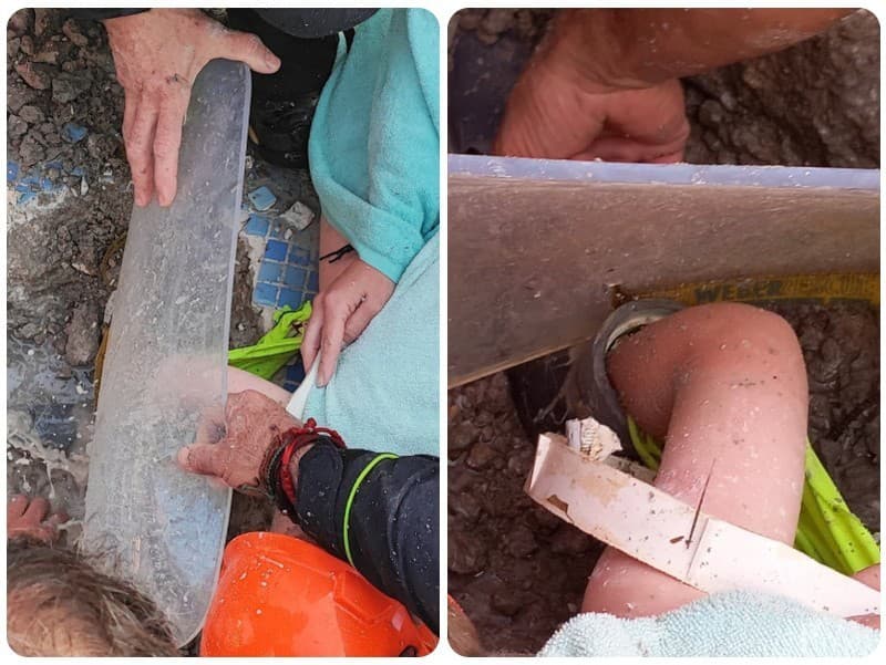 Chlapcovi uviazla vo filtri ruka, záchranný tím mal čo robiť, aby chlapcovu ruku vytiahol