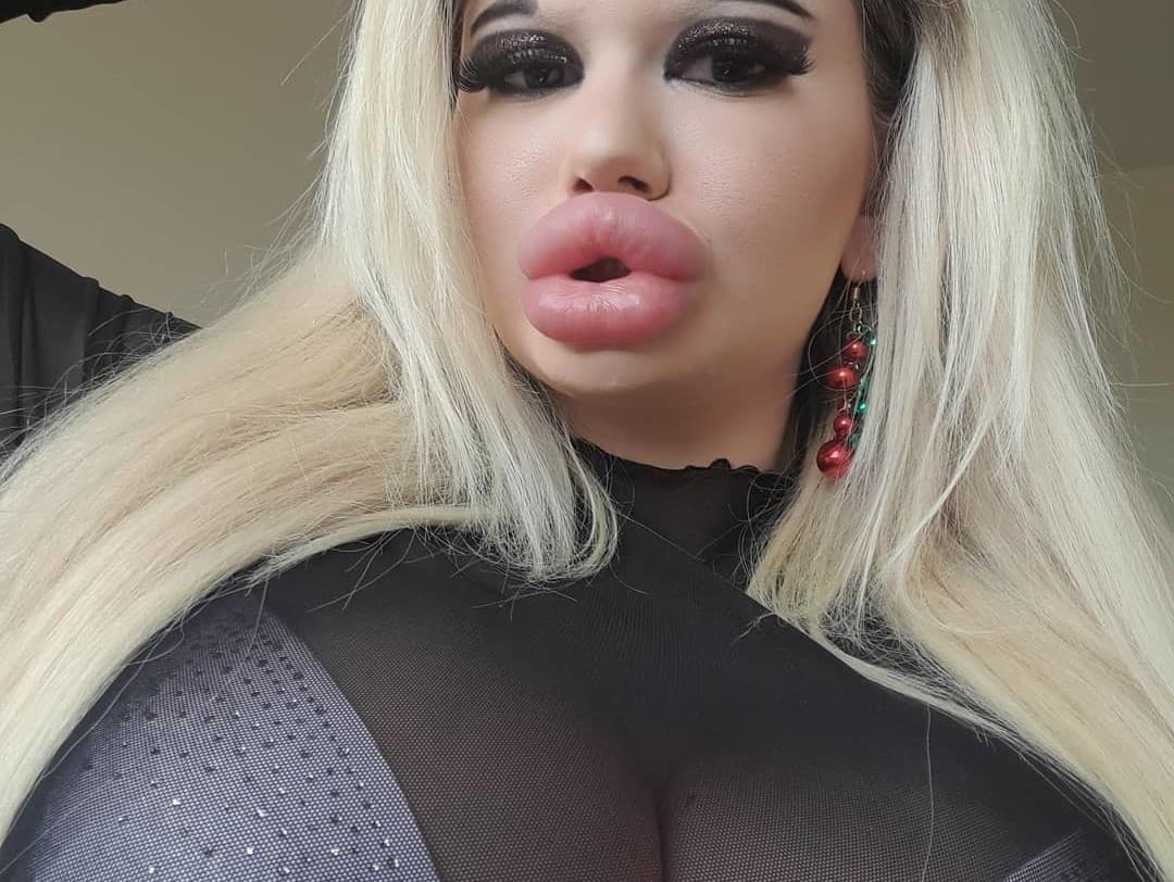 Dvadsaťosemročná Andrea Ivanova  si necháva celé roky zväčšovať pery, aby dosiahla svoj cieľ a mala ich „najväčšie na svete“