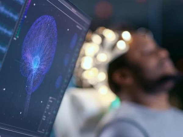 Ilustračný obrázok