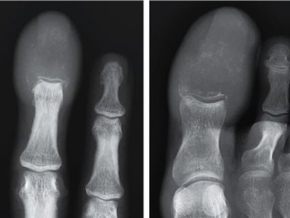 Lekári najskôr predpokladali, že ide o zápal, infekciu alebo dnu, no röntgenové snímky odhalili šokujúcu pravdu