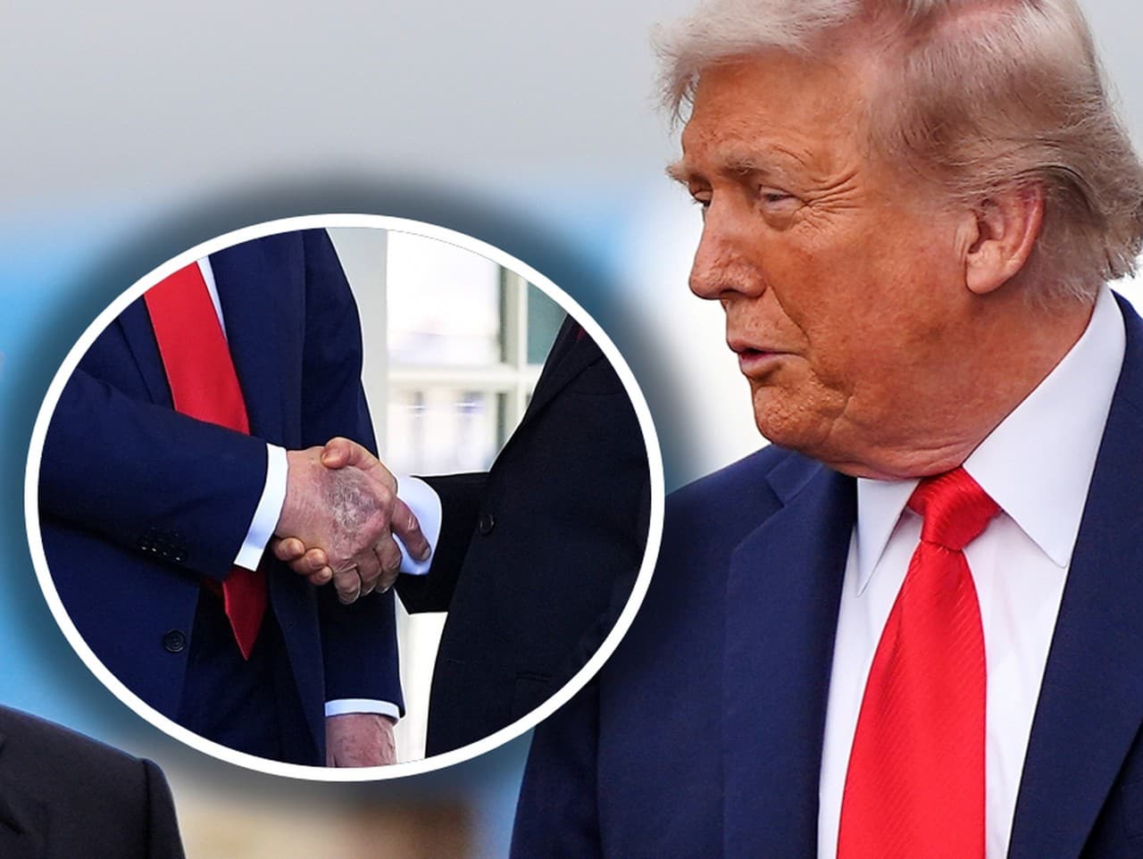 Trump mal na ruke viditeľnú veľkú modrinu.