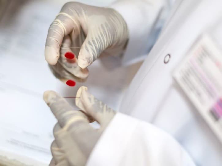 Ilustračný obrázok