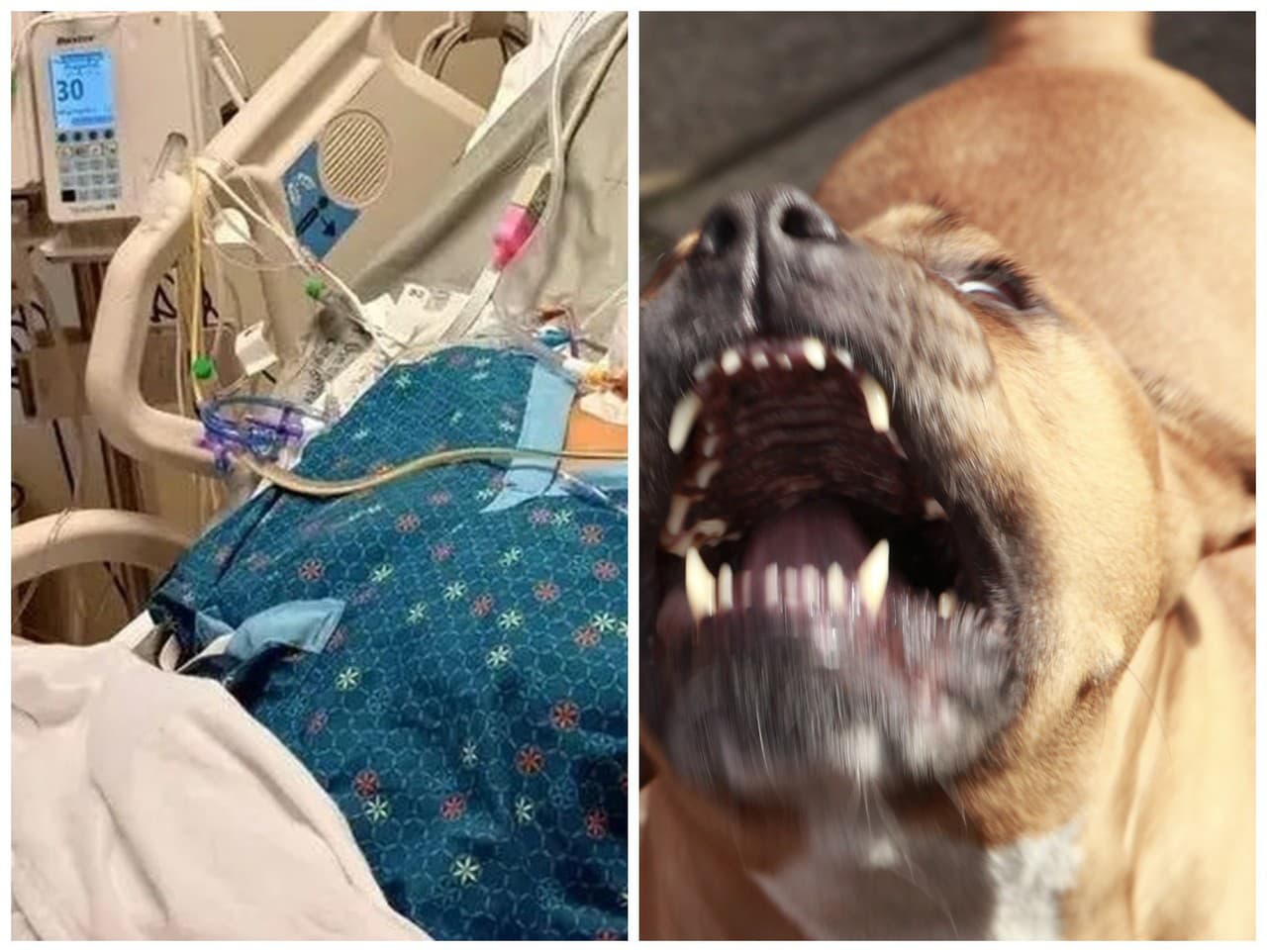 Žena prišla o všetky končatiny.