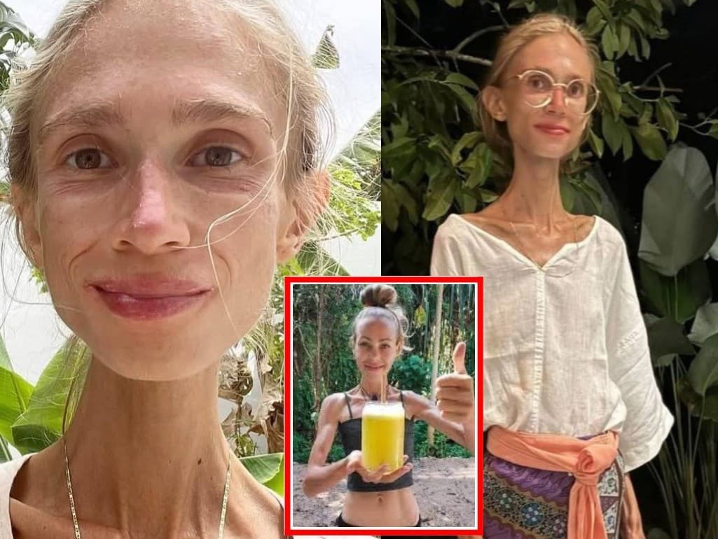 Poľská študentka Karolina Krzyzáková (†27) bola dlhé roky frutariánkou. Zomrela počas dovolenky na Bali
