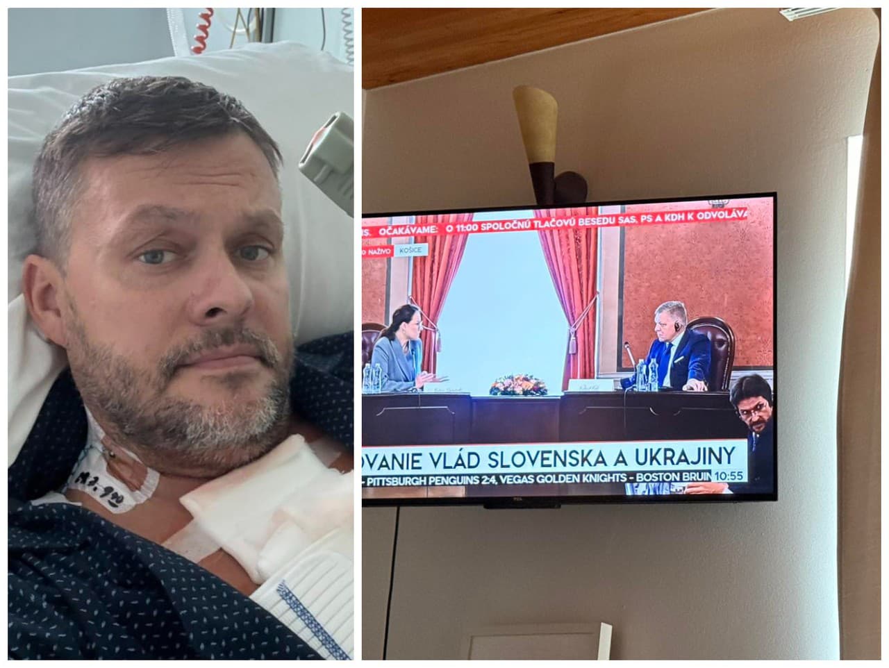 Migaľ skončil pripútaný k posteli s ochorením covid-19.