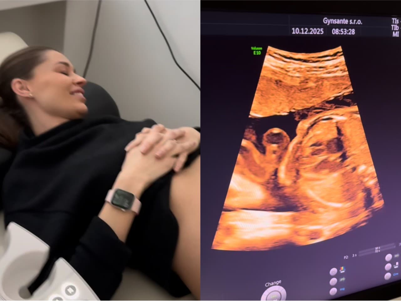 Partnerka Jána Ďuricu je opäť tehotná