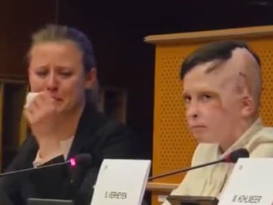Na pôde EÚ vystúpil aj Roman Oleksiv (11) z Ukrajiny, ktorý zostal znetvorený po jednom z ruských útokov. Jeho tlmočníčka nedokázala skrývať slzy. 