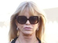 Goldie Hawn bojuje proti starobe pomocou rôznych zákrokov a procedúr. 