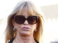 Goldie Hawn sa plastikami pier dopracovala k vskutku nelichotivej podobe.