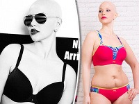 Elly Mayday skúšaná rakovinou bez ostychu predvádza prirodzené ženské telo bez vlasov a s jazvami.