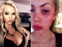Sexica Michaela Gašparovičová na uplynulý štvrtok tak skoro nezabudne - zbil ju opitý útočník.