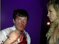 Josie Gibson nedokáže skryť svoje zdesenie nad tým, že jej sluchovo postihnutého brata zmlátili útočnici do krvi. Josie Gibson nedokáže skryť svoje zdesenie nad tým, že jej sluchovo postihnutého brata zmlátili útočnici do krvi.