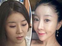 Televízna reportérka z Južnej Kórey šokovala svet drasticky zmenenou tvárou po plastikách.