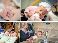 Predčasne narodené bábätká