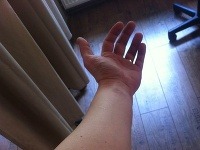 Takto vyzerala ruka pred tetovaním