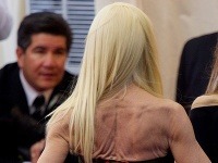 Vychrtlina Donatella Versace strašila na červenom koberci zošúvereným telom.