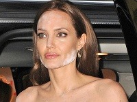 Angelina Jolie prekvapila na premiére viditeľnými fľakmi na tvári aj na tele.