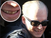 Usmiaty Johnny Depp vyceril hnedé a zanedbané zuby. Usmiaty Johnny Depp vyceril hnedé a zanedbané zuby.