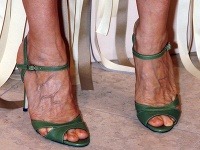 Sarah Jessica Parker často predvádza starecké chodidlá v sandáloch.