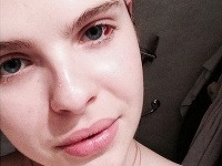 Emma Müllerová sa na sociálnej sieti pochválila fotkou, ktorá zachytáva nové tetovanie očného bielka. 