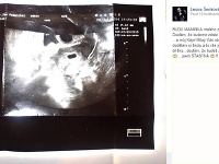 Leona Šenková oznámila svojim fanúšikom, že je tehotná. 