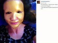 Veronika Nízlová zverejnila fotografiu so špeciálnou maskou na tvári. 