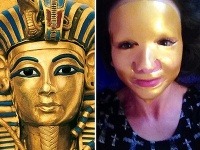 Veronika Nízlová sa po zákroku cítila ako Tutanchamón. 