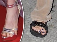 Mnohé celebrity si potrpia na ukážkový zovňajšok, no na svoje zdeformované chodidlá v topánkach kašlú.