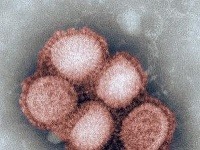 Vírus prasacej chrípky