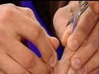 Dva zrastené prsty Ashtona Kutchera