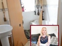 Andrea utrpela menšie popáleniny Andrea utrpela menšie popáleniny