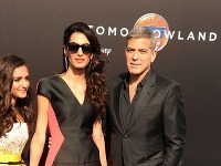 Amal Clooney rozhodne nevyzerá zdravo. Mnohí ju upodozrievajú z anorexie. 