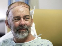 Lekári v Texase ako prví vo svete transplantovali pacientovi časť lebky Lekári v Texase ako prví vo svete transplantovali pacientovi časť lebky