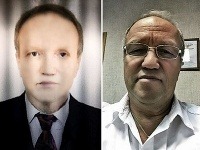 Semen pred a po transplantácii Semen pred a po transplantácii
