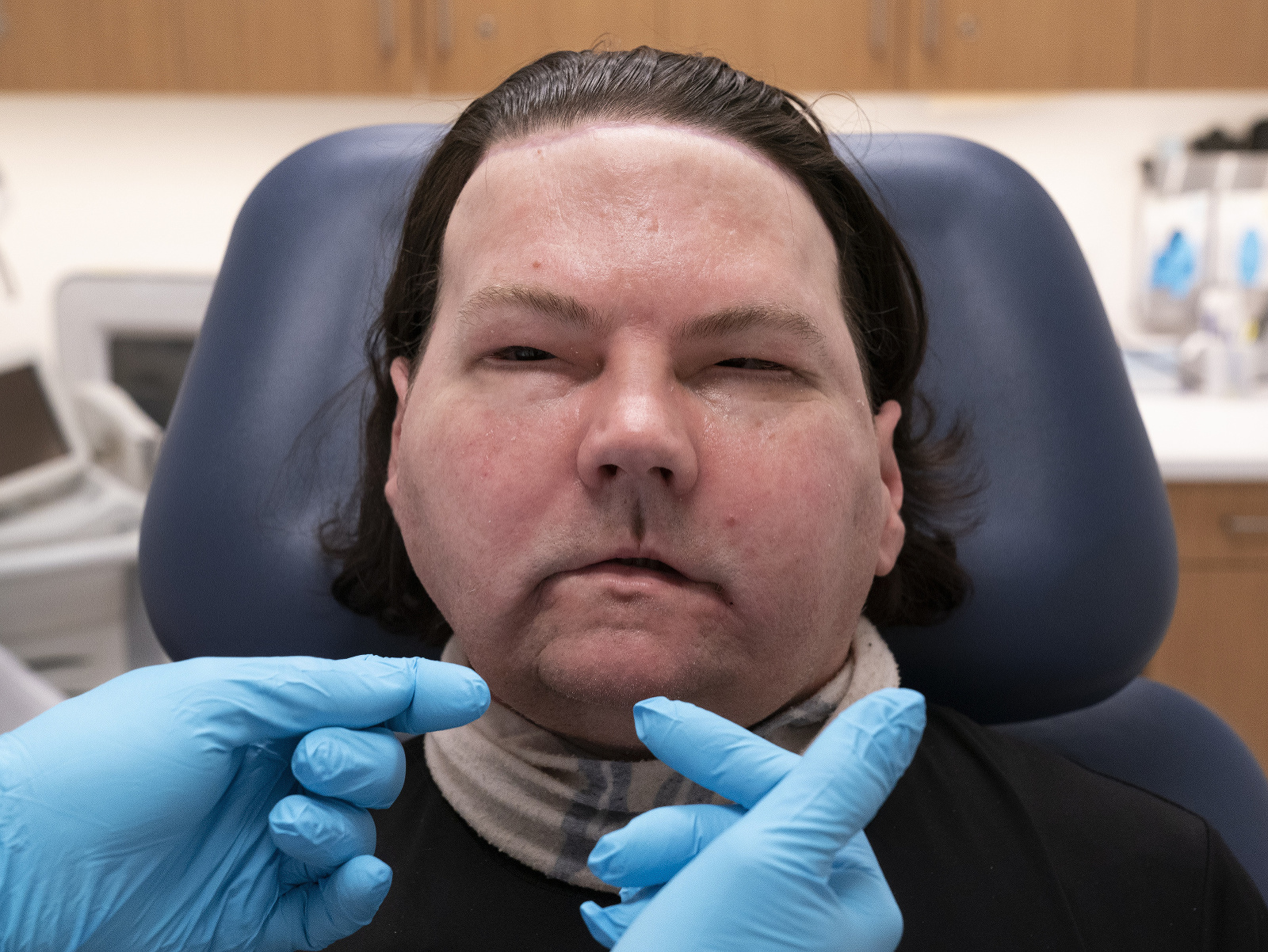 Mladý muž, ktorému transplantovali