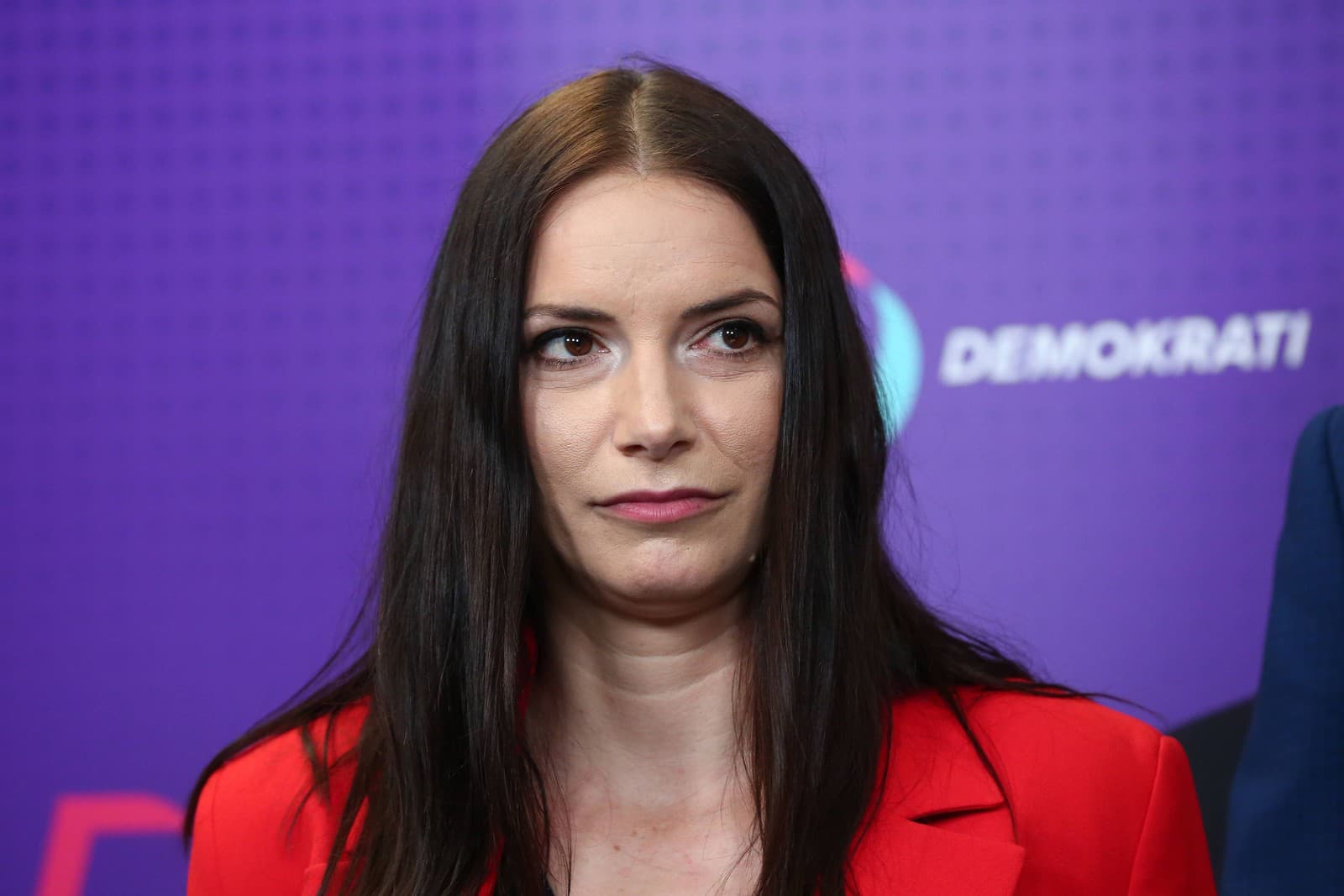 Politici v šoubiznise: Boli