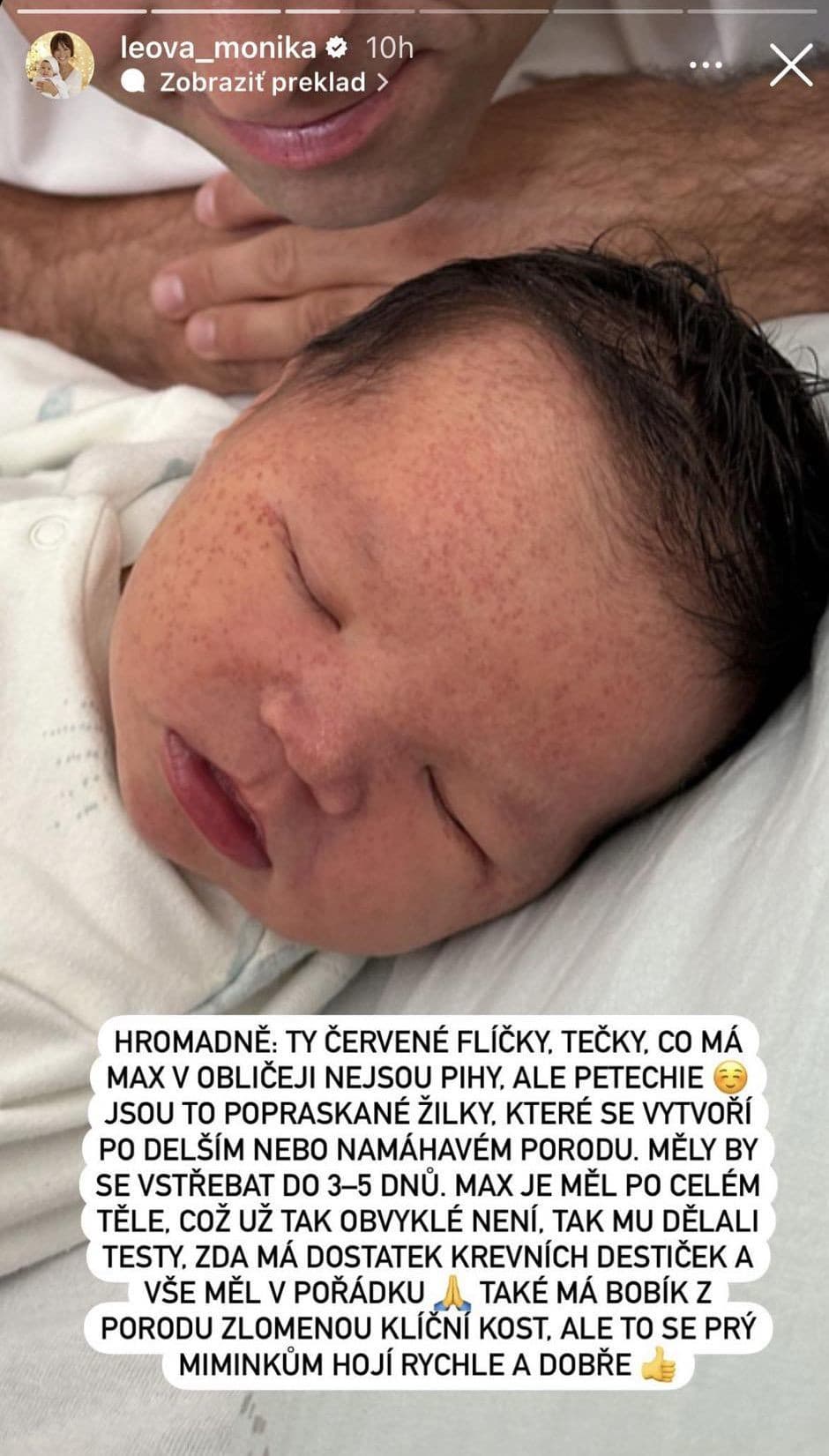 KOMPLIKOVANÝ pôrod českej moderátorky: