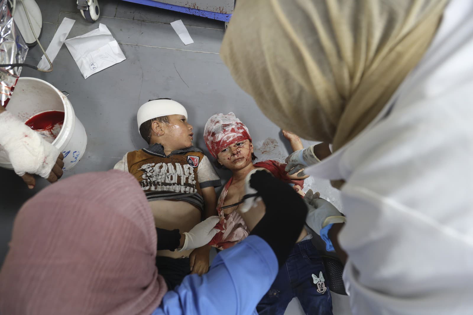 Palestínske deti ošetrujú v nemocnici al-Aksá po izraelskom bombardovaní