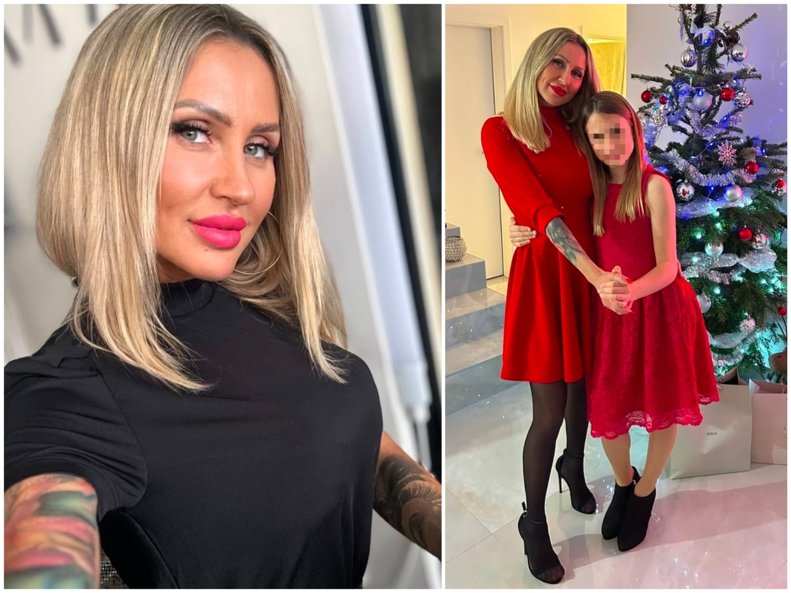 Boľavé rany, ktoré sa