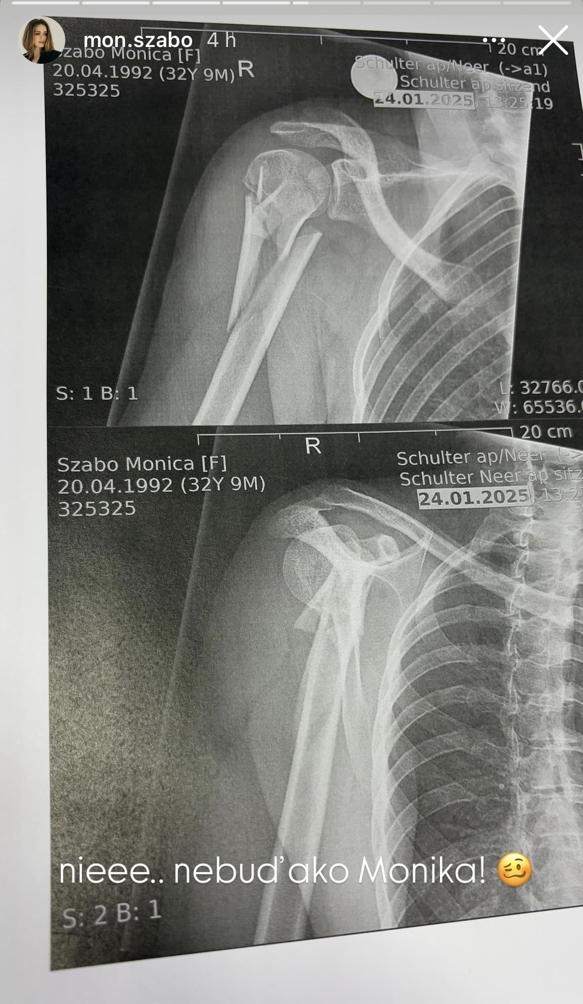 VÁŽNA nehoda slovenskej herečky