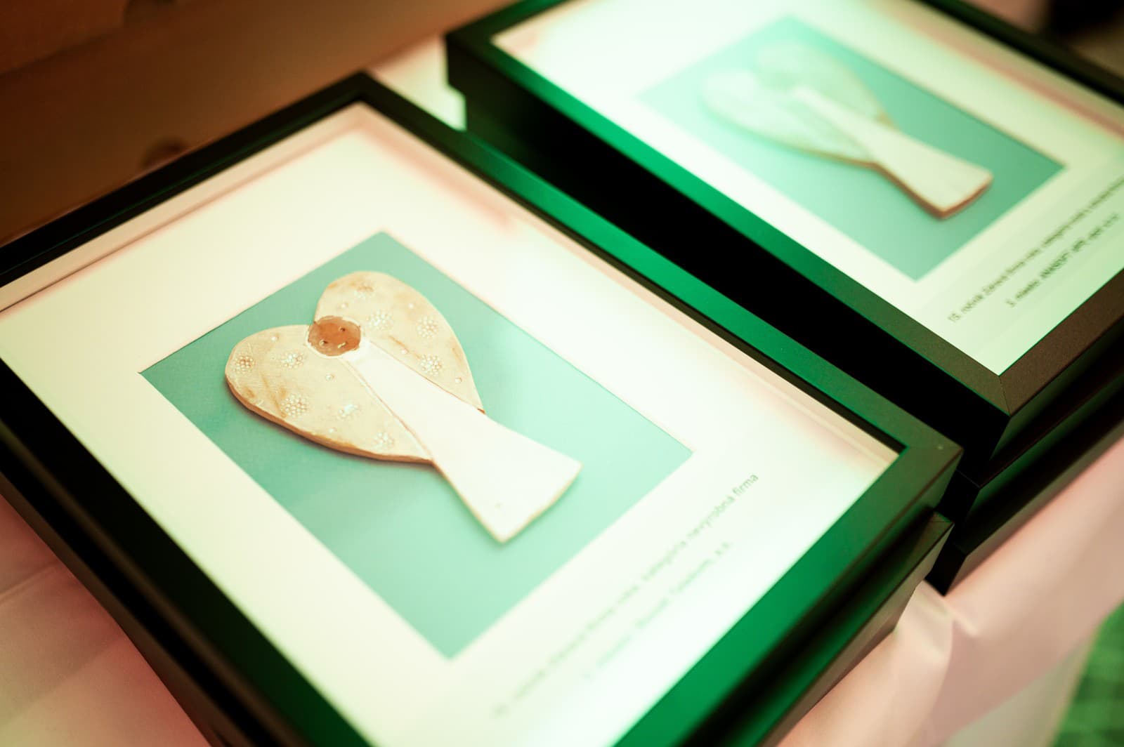 Kontrola zraku či EKG