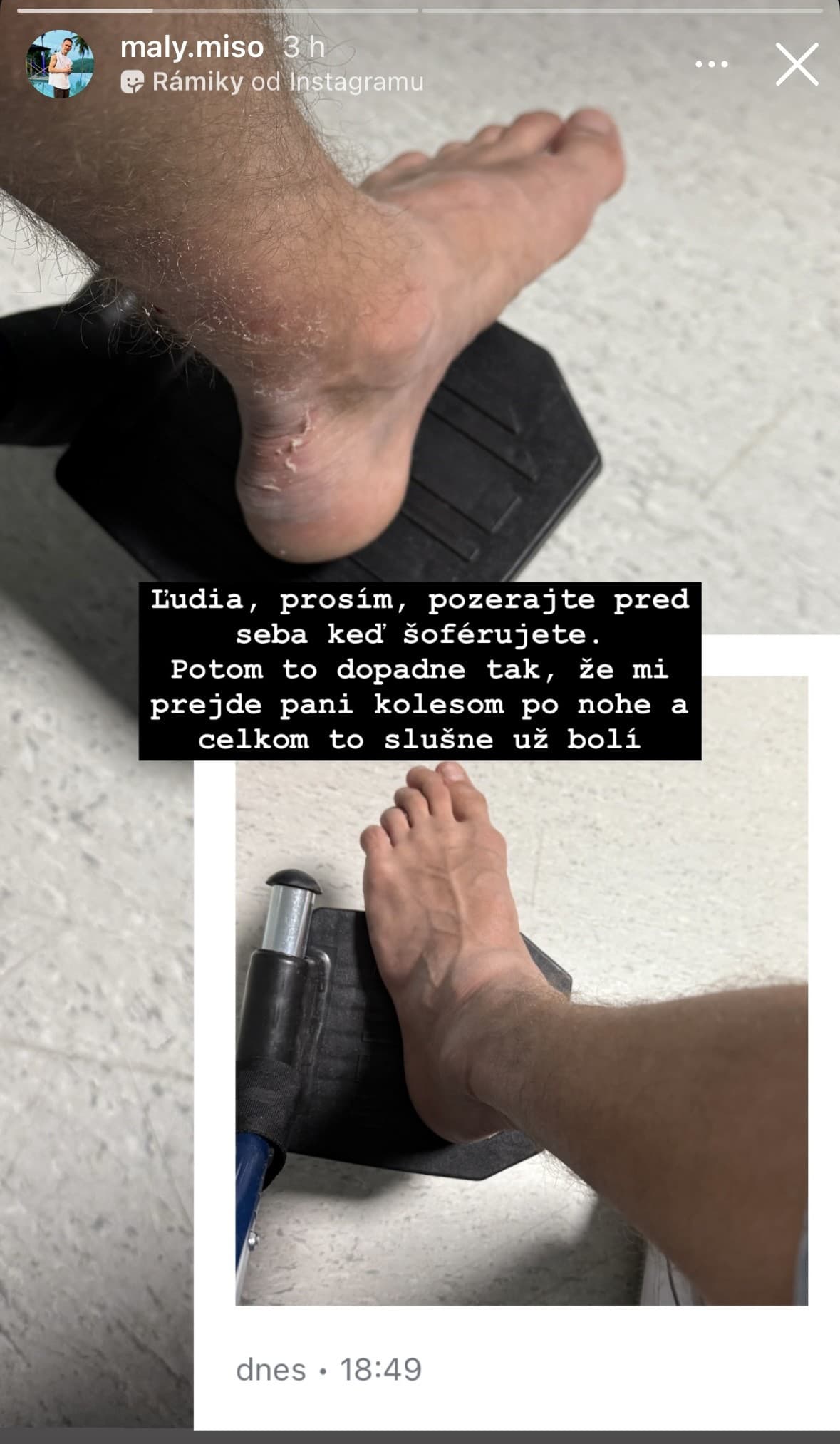 VÁŽNE zranenie dôležitého muža