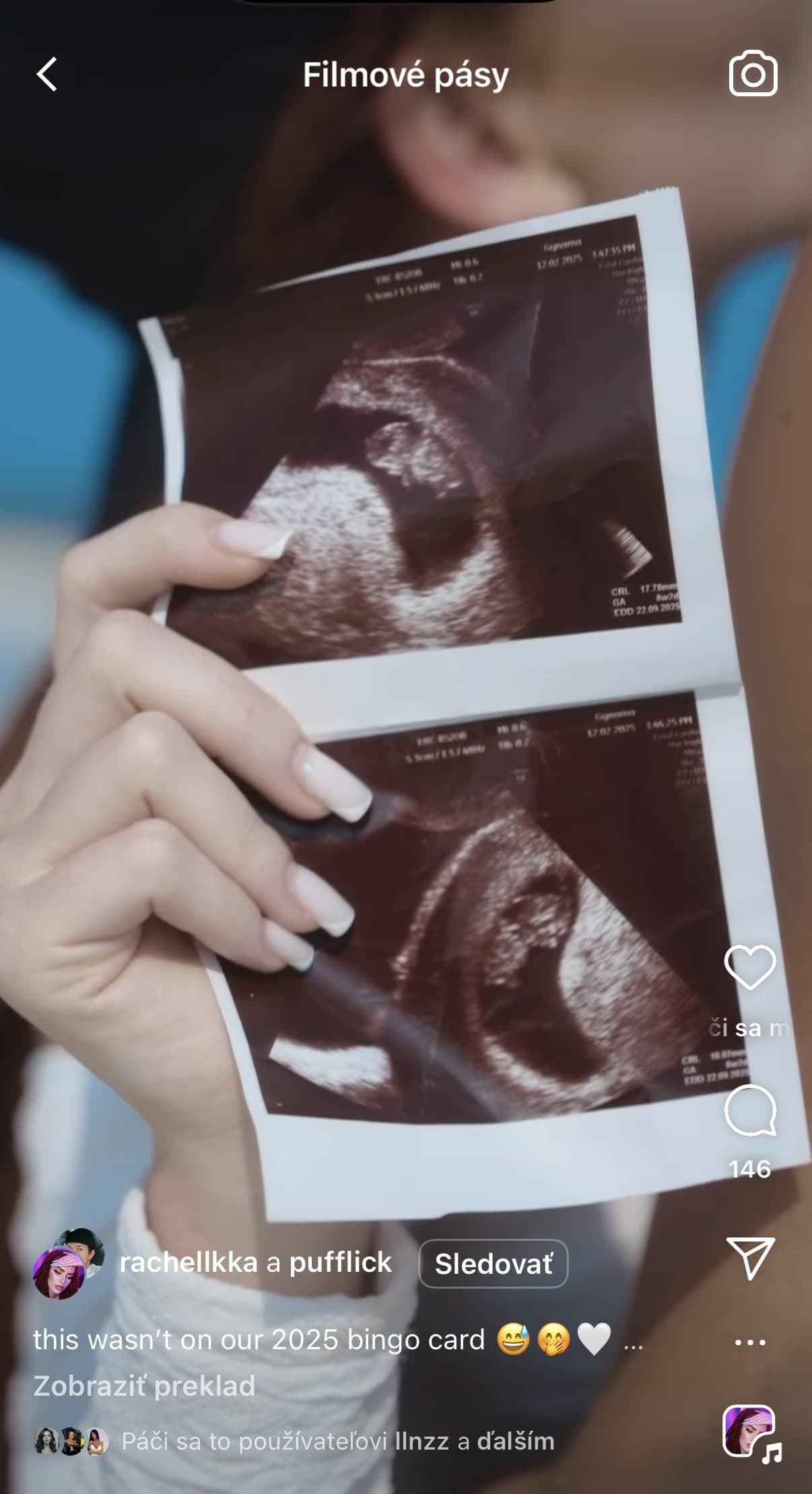 TEHOTNÁ Ráchel: Myslela si,