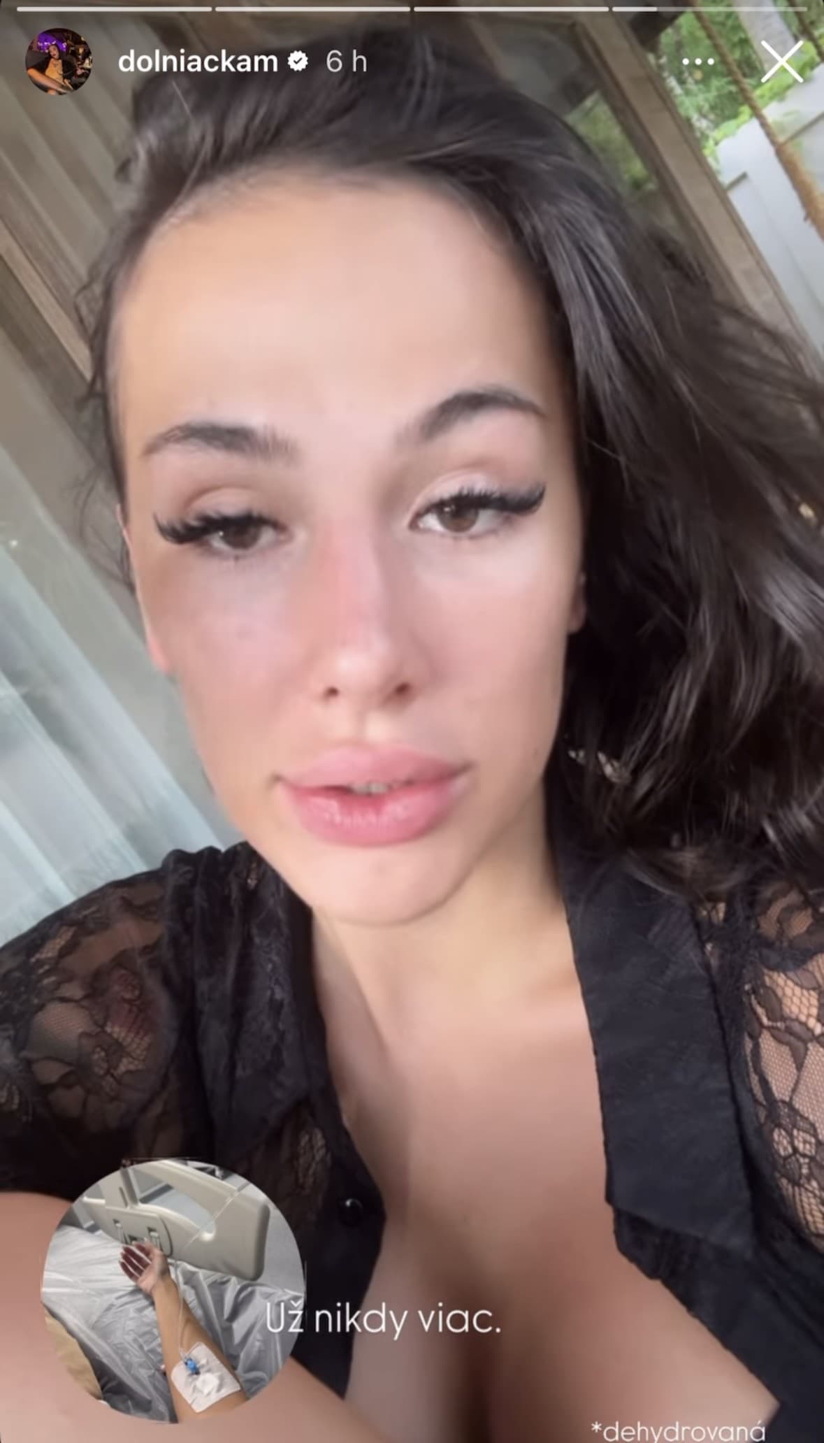 Ťažkosti známej krásky: OTRAVA