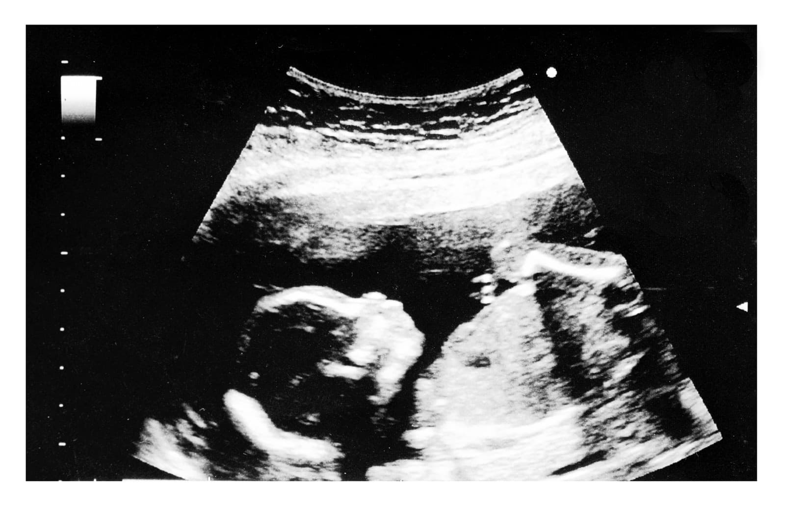 Tehotná žena (32) balansovala