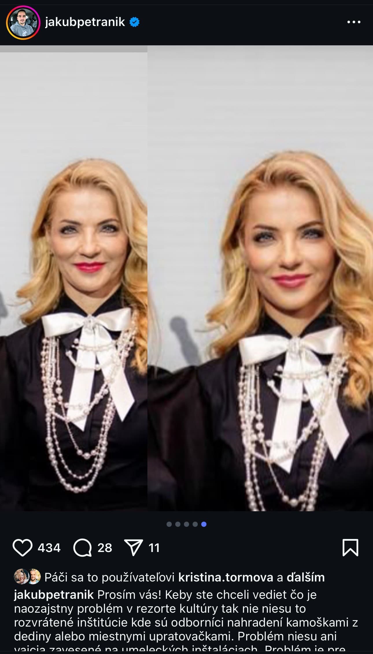 Martina Šimkovičová to s retušou trošku prepískla